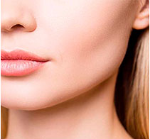 Aumento de labios.