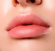 rellenos de labios con acido hialuronico maria linda volumen