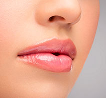 rellenos de labios con acido hialuronico maria linda filtrum